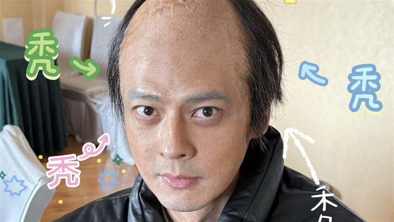昔赴陸尋根挨轟 郭品超變禿頭近照嚇壞網