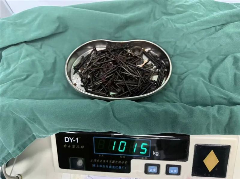 36歲男子趁家人不注意吞下大量鐵釘及金屬物，總重量約1公斤。（圖／翻攝自澎湃新聞）
