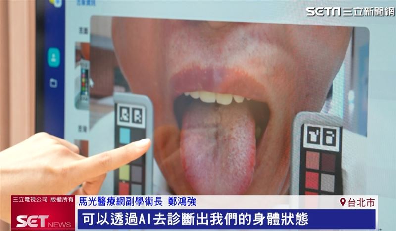 馬光醫療網與友達耘康合作，將AI舌診納入現場，透過AI診斷出身體狀態