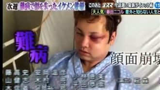 開顱7小時慘毀容　男星術後7年癲癇發作