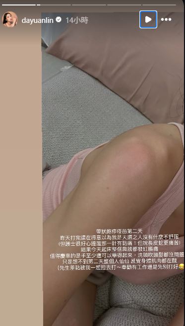 大元也貼心提醒,近期有工作的人先不要施打。(圖/翻攝自IG @dayuanlin)