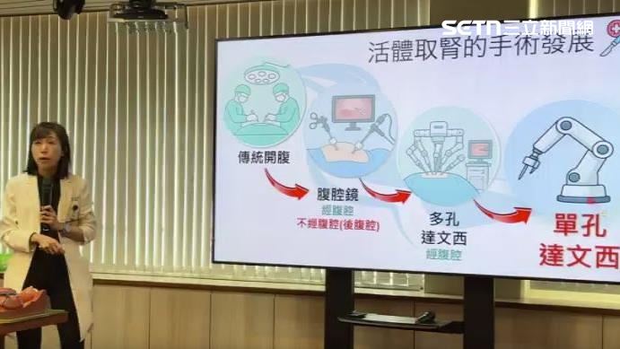 手術採用單孔達文西手術