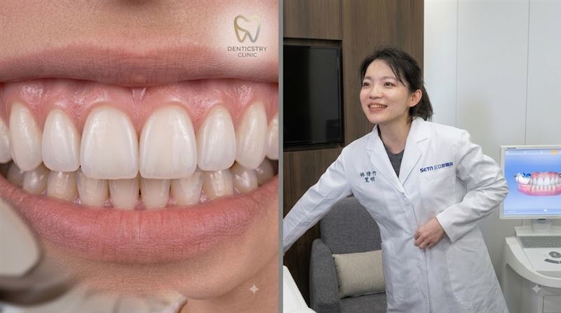 陳幸妤勸退病人做牙齒貼片！11字金句瘋傳