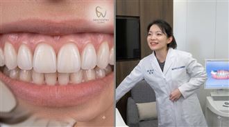 陳幸妤勸退病人做牙齒貼片！11字金句瘋傳