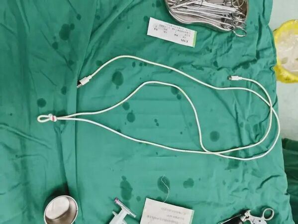 醫護緊急開刀，在男子泌尿道內取出80公分充電線。（圖／翻攝自南方都市報）
