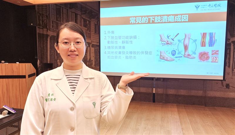 王羽安醫師提醒,腳踝潰瘍反覆紅腫別亂擦藥,儘早就醫。(圖/奇美醫院提供)