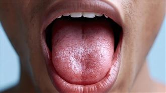 張嘴吐舌看健康！從「舌苔」窺探五臟密碼