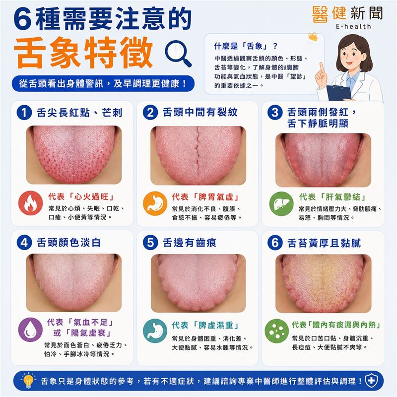 張嘴吐舌看健康!從「舌苔」窺探五臟密碼,6種常見舌象一次看懂。(圖/醫健新聞網提供)