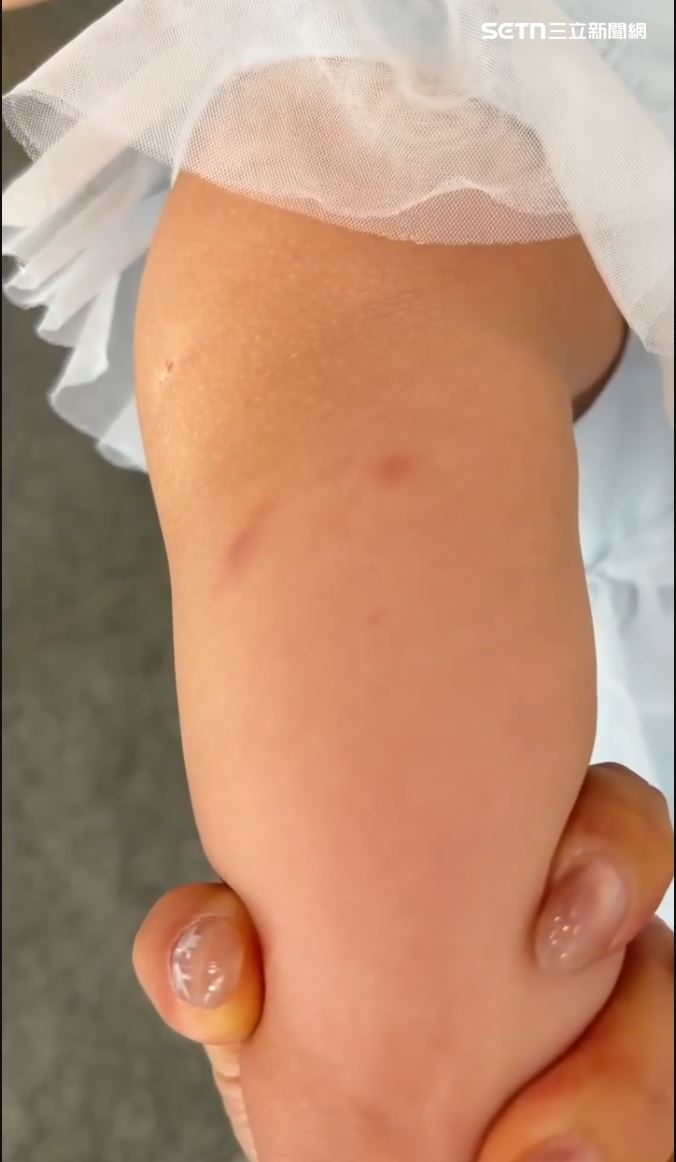 一名4歲女童日前疑因不慎推倒椅子,竟遭園內教保員粗暴按壓、掐捏並拖拽,導致女童全身多處瘀青、腋下紅腫,手臂瘀青。(圖/翻攝畫面)