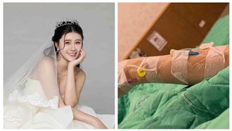 林真亦突入院。（圖／翻攝自林真亦臉書）