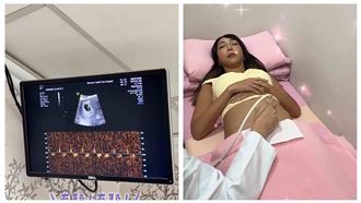 又懷第6胎　資生堂千金被酸白做腹部拉皮