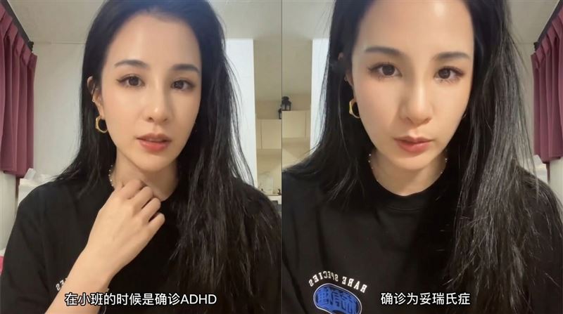 呆寶靜發文透露兒子的情況,並藉此分享自己的經驗。(圖/翻攝自Threads @holysweet)