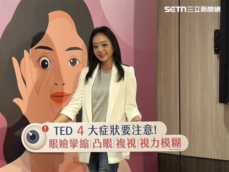 金鐘影后高慧君說自己罹患甲狀腺眼病變。(圖/記者簡浩正攝影)