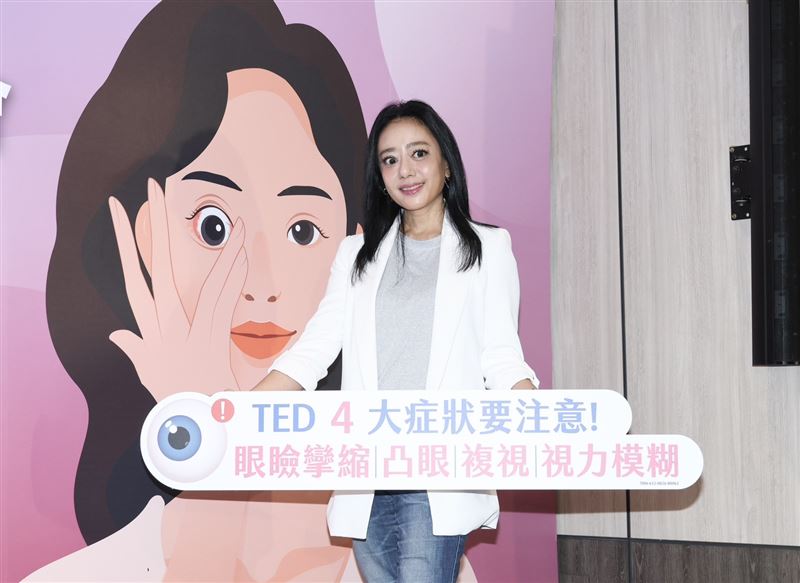 談及五熊潑油爭議,高慧君盼尊重不同的生活習慣。(圖/記者田俊彥攝影)