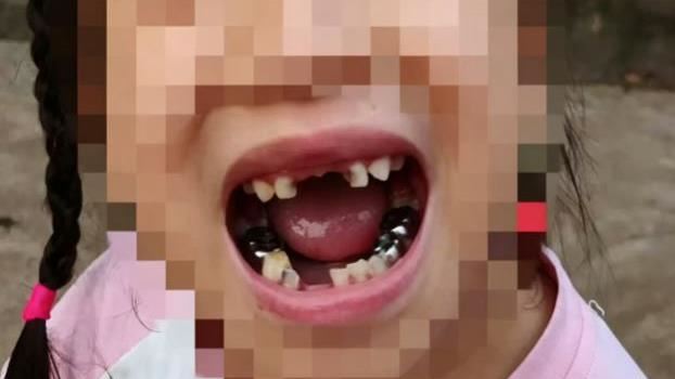 女童遭機器人「爆頭迴旋踢」：宇樹科技的