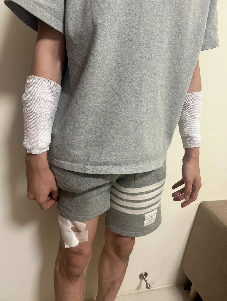 陳姓男護理師自稱於後龍高鐵新站附近遭人持刀砍傷，警方調查後案情出現大逆轉，他坦承受傷全是自導自演。（圖／民眾提供）