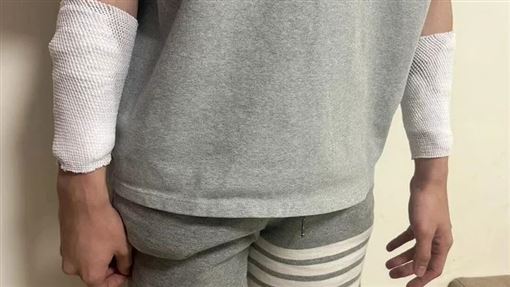 護理師被砍全是假　工作壓力大自傷想討拍