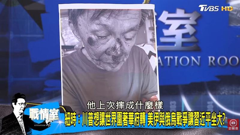 沈富雄在政論節目中公開受傷畫面。(圖/翻攝《少康戰情室》)