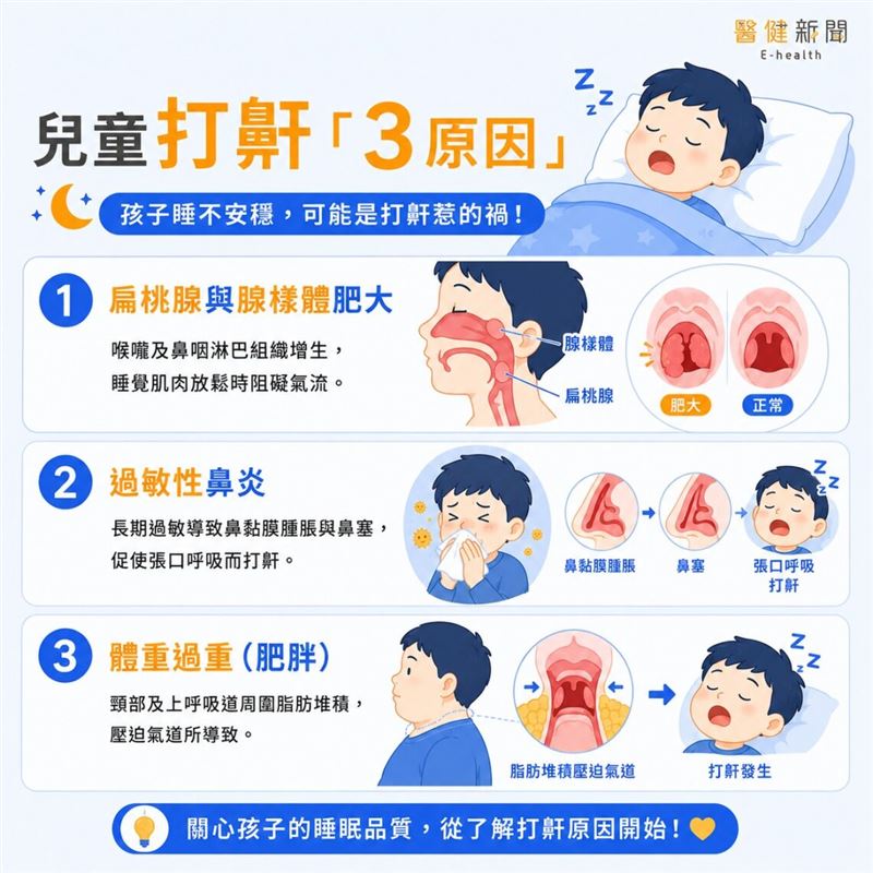 孩子打鼾恐影響大腦發育!兒科醫引研究揭「3原因」。(圖/醫健新聞網提供)