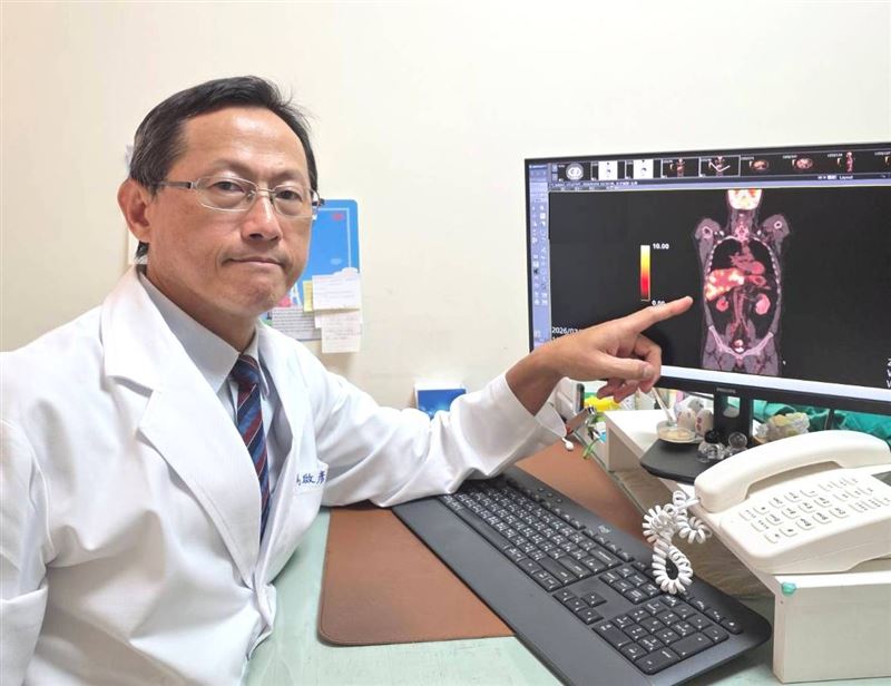 男子肛門出血近1年,看醫生看不好,經正子掃描才知罹患直腸癌第四期。(圖/大千綜合醫院提供)