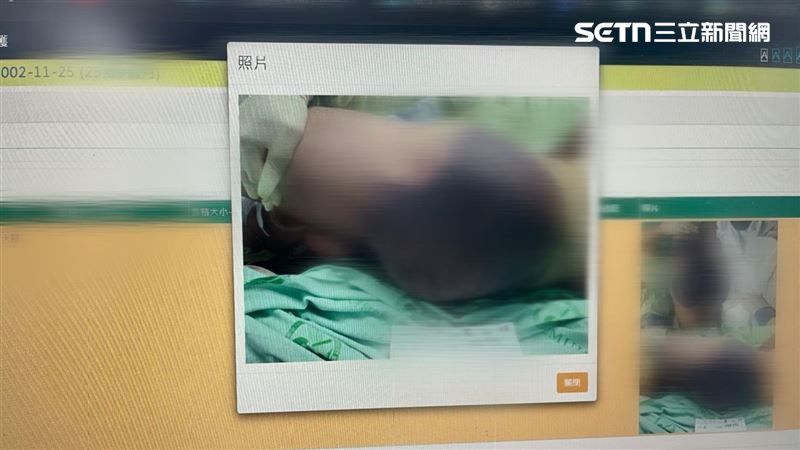 24歲空軍「突說不出話」亡…臀部爬滿瘀青