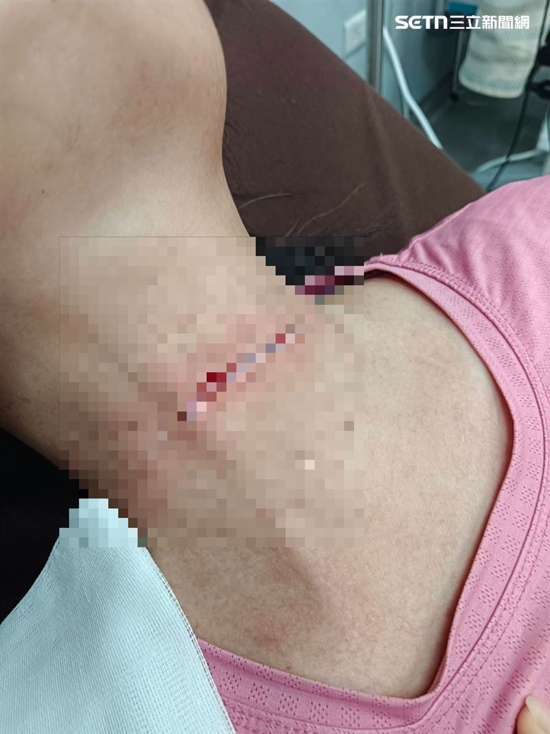 廖小姐起初以為脖子被人掐住,事後才驚覺有條細鐵線勾勒著脖子。(圖/當事人提供)