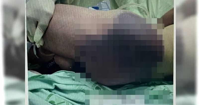 嘉義防空連服役的24歲侯姓志願役上兵,疑因債務糾紛遭2嫌持球棒施暴,臀部大面積瘀青,緊急送醫仍不治。(圖/翻攝畫面)