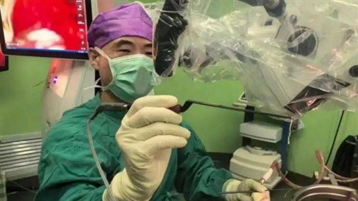 藏腦內7年！女喪失語言能力　醫揪5cm活蟲