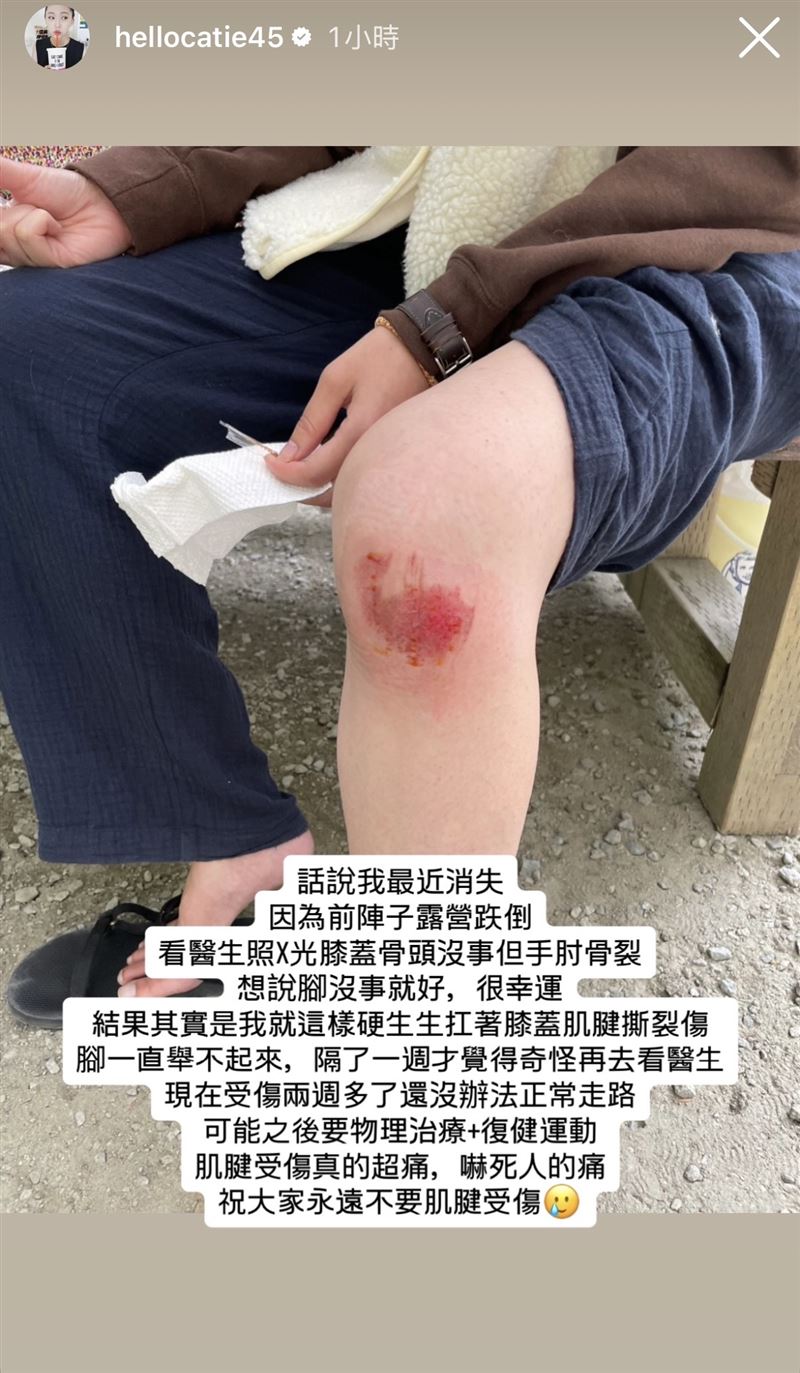 Catie因露營跌倒,導致手肘骨裂、膝蓋肌腱撕裂傷。(圖/翻攝自IG @hellocatie45)