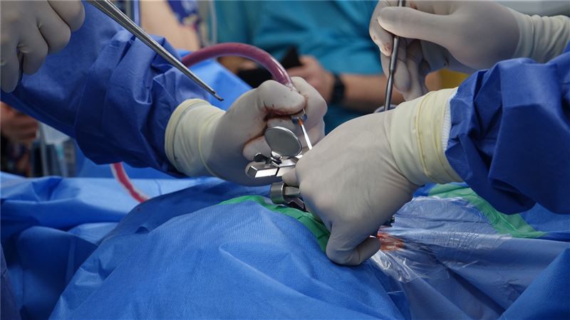 遭前夫潑酸毀容抗病26年！歷經80次手術