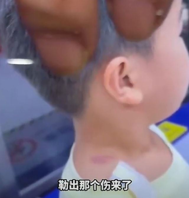 男童父母指出,女方抓住男童時有勒脖子的動作,孩子頸部出現勒痕及淤青。(圖/翻攝畫面)