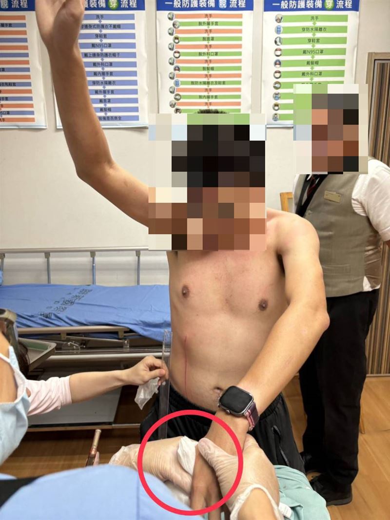 救援過程中,黃姓實習生左手虎口遭割傷、腹部留下一道20公分的劃傷。(圖/翻攝畫面)