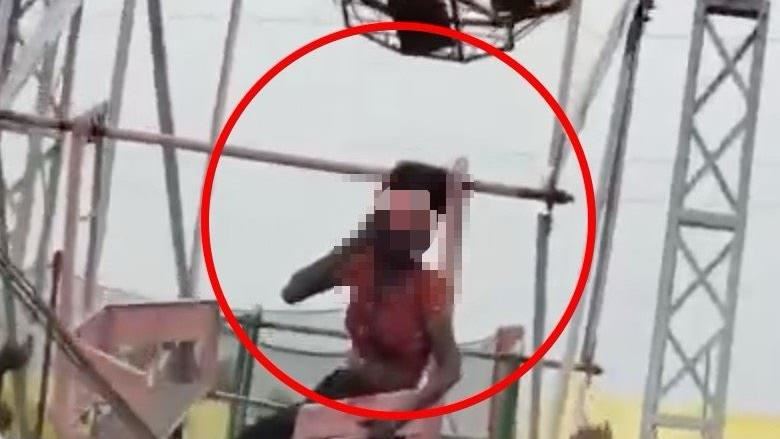 長髮捲進摩天輪軸承　女頭皮「整片」被掀