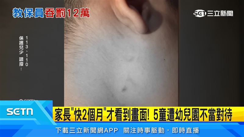 等近兩個月才看到監視器,還發現另有5名孩童疑似受害,家長認為處分過輕