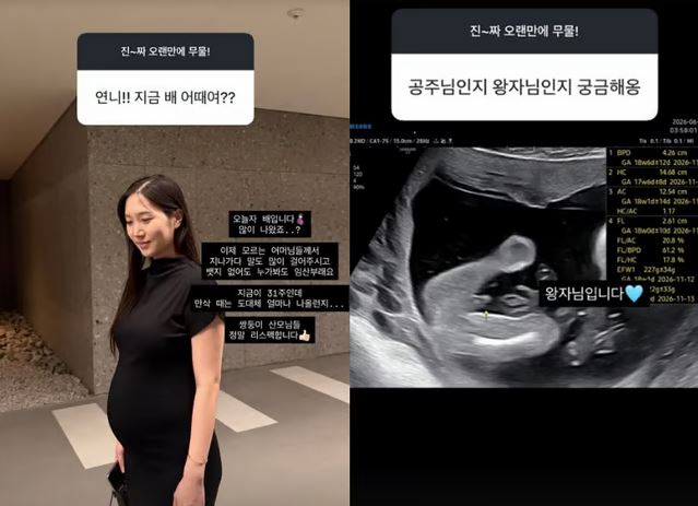 洪瑜暻透過IG限動回答粉絲對於孕況的好奇提問。(圖/翻攝自IG @yukyung_922)