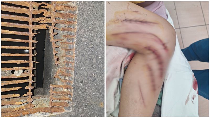 吃人水溝蓋！國一生「腿遭割爛」縫17針