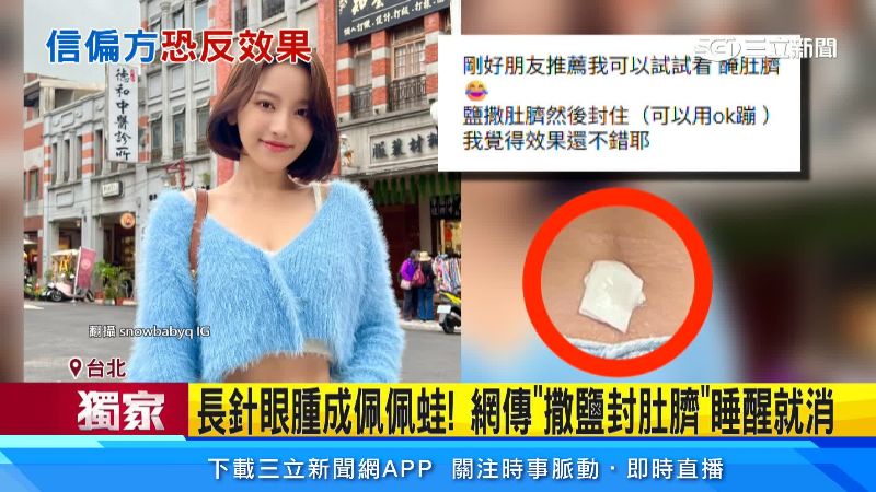 蔡瑞雪也曾經分享過此療法。(圖/翻攝自IG @snowbabyq)