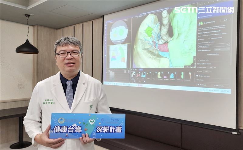 健行男肺0.9cm結節　免打顯影劑精準切除