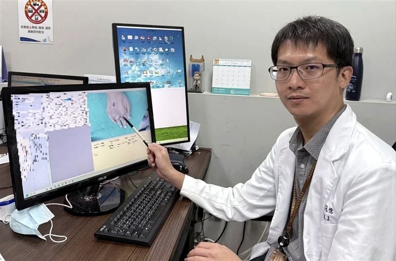 醫師陳冠儒說明,微創痛風石切除手術的精髓,在於拚全力留住完整的皮膚與關節的功能。(圖/長安醫院提供)