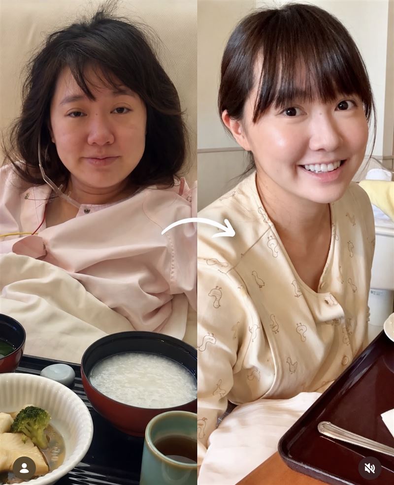 Mana公開產後對比照。(圖/翻攝自IG)