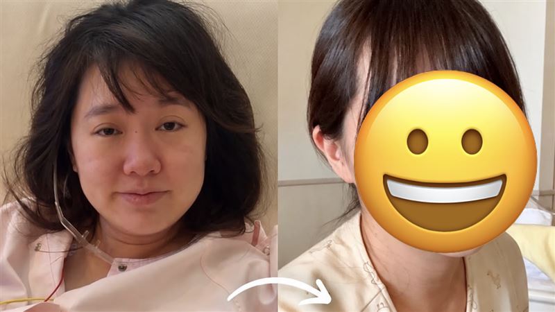 YTR剖腹產女 產後對比照曝光:變化超大