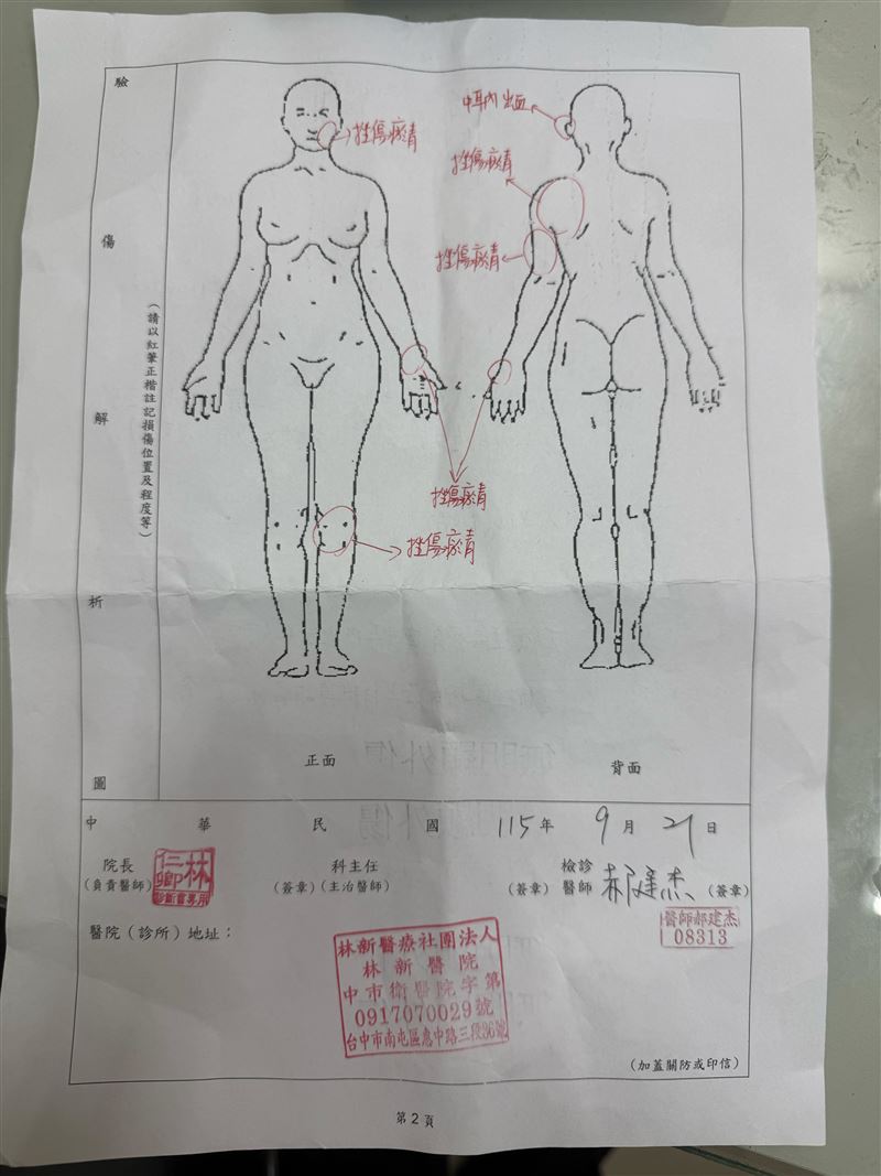 李沛綾遭前夫長期家暴,今日鼓起勇氣持驗傷單前往警局提告。(圖/翻攝畫面)