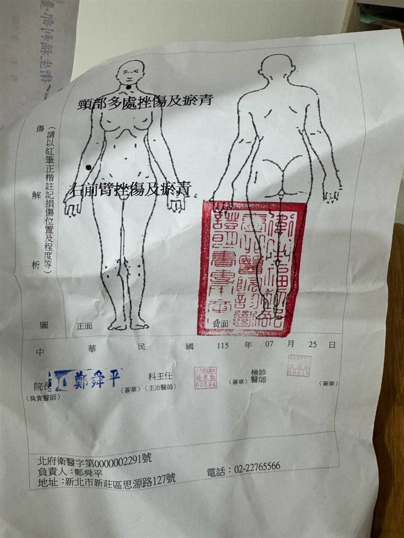 今年7月25日時,李沛綾曾遭前夫毆打、徒手掐脖子。(圖/翻攝畫面)