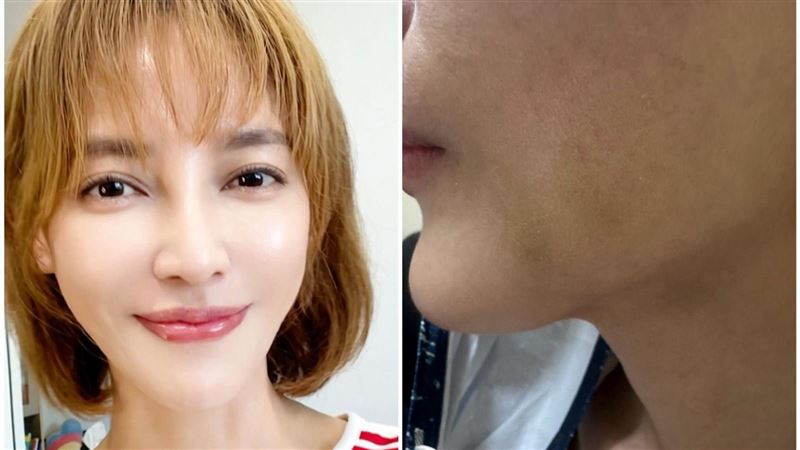 台八女星遭痛毆傷勢曝！忍痛單手駕車返北