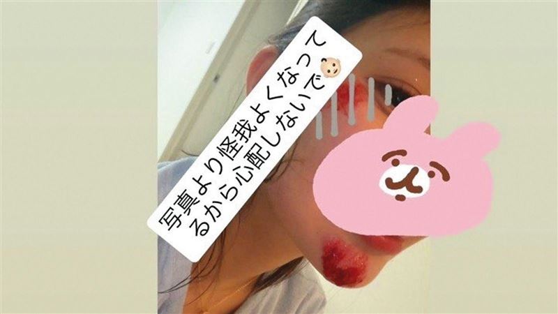 遭牛郎男友施暴「公司知情」倉木華：絕望