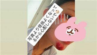遭牛郎男友施暴「公司知情」倉木華：絕望