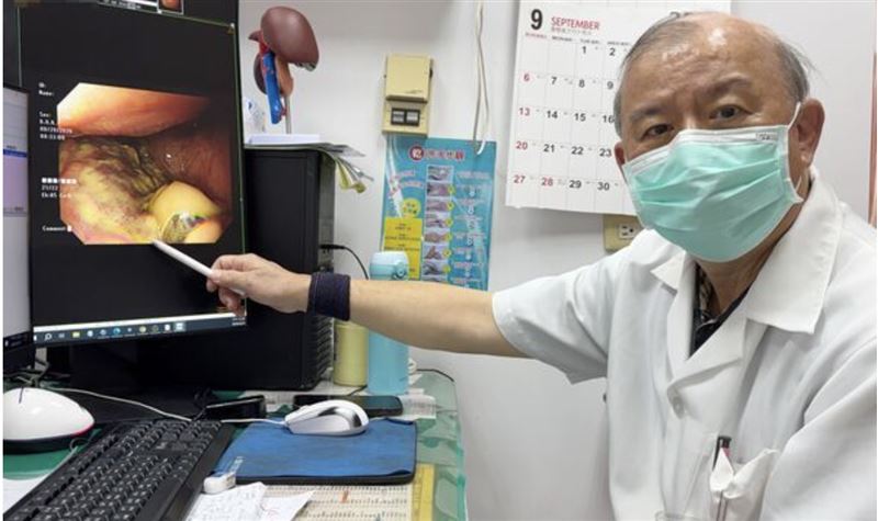 賴大豊醫師提醒,長年嚼檳榔、飲酒皆為口腔癌的極高危險因子。(圖/翻攝畫面)