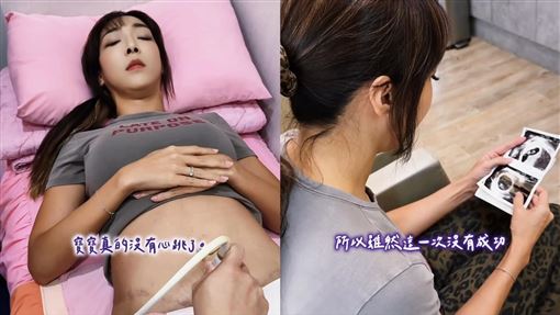 資生堂千金悲痛認六寶流產：會努力生回來