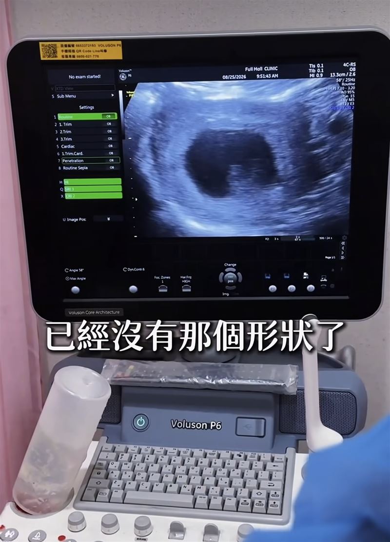 李宓透露六寶已經看不清形狀了。（圖／翻攝自IG）