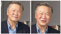 賴岳謙"臉長馬蜂窩"　周玉琴急退通告就醫
